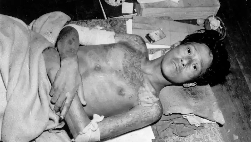 Nagasaki'den Uyanış: Nükleer Felaket Tehlikesine Dikkat Çekiliyor