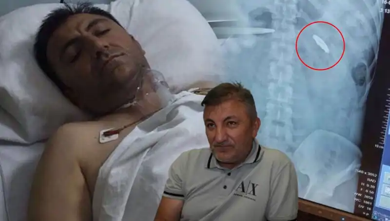 15 Temmuz’un Karanlık Yüzü: Kurşun Yaralarıyla Yaşayan Bir Kahraman