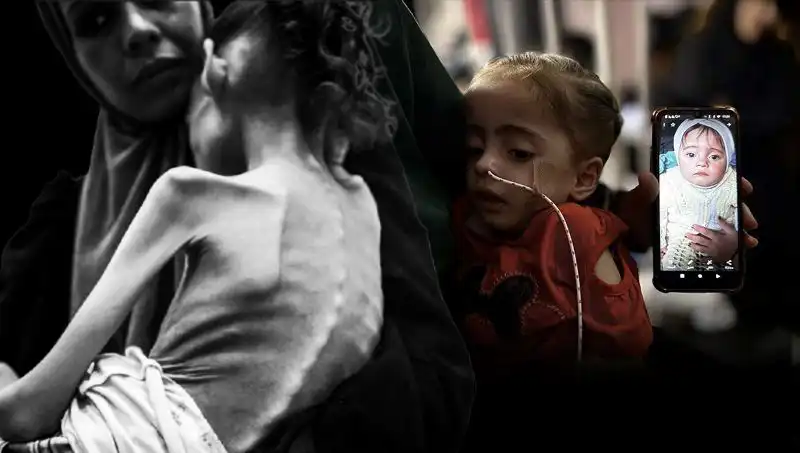Küçük Meryem’in Zorlu Mücadelesi: 25 Kilo, 10 Kiloya İndi